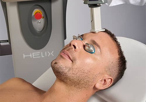 Man with Helix device being used on his forehead