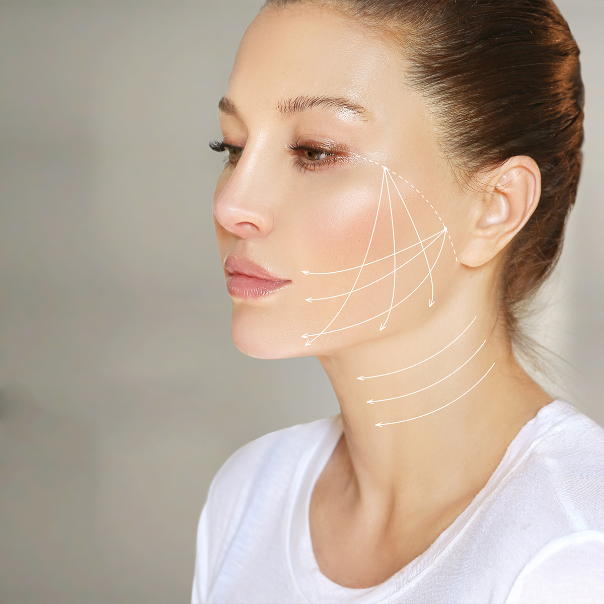 Younger woman posing with beautiful skin and lines to show skin tightening areas