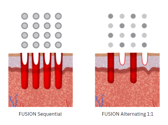 Fusion scan patterns image