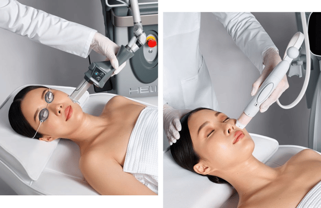 Helix and Coolpeel treatments being done on woman patient in lightly lit room