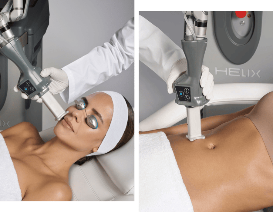 Helix Fusion being used on stomach and face