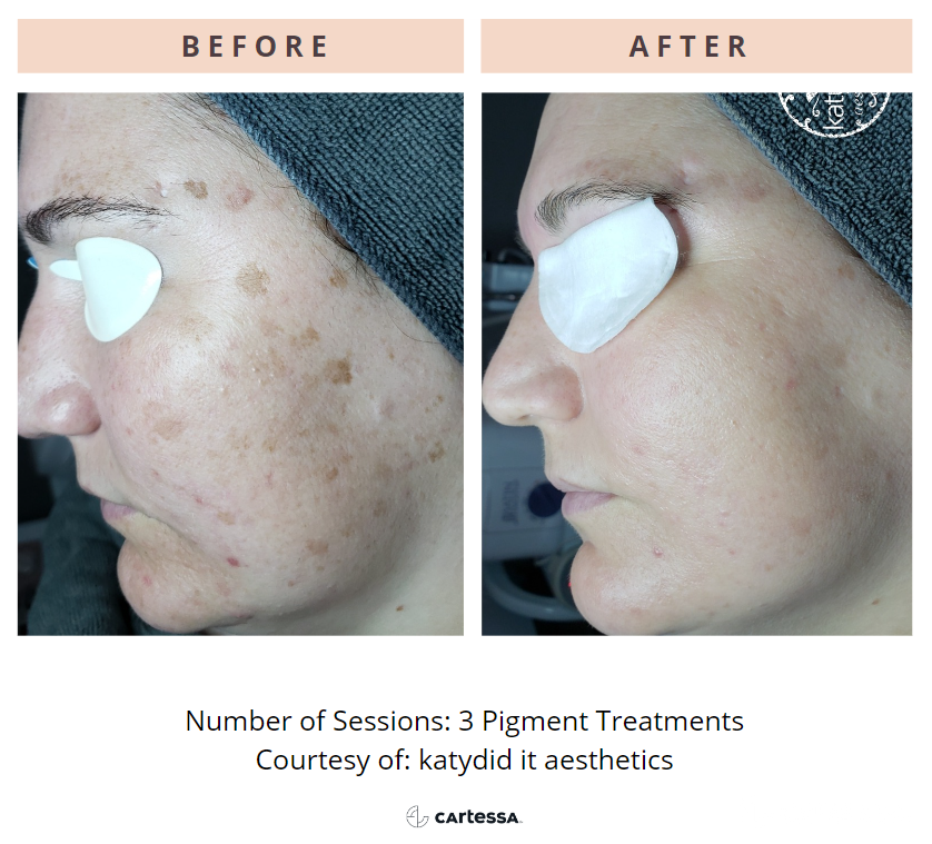 headshot of Katy Stelter and Raechel Loew Jaap