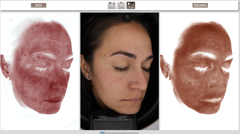 Visualization of reds and browns